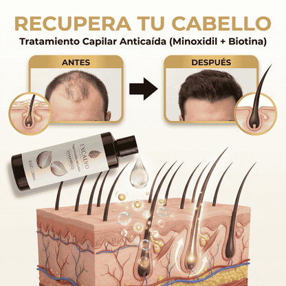 EXCALVO💆‍♂️ shampoo nutricional de cebolla🧅 canela y gengibre 🌿