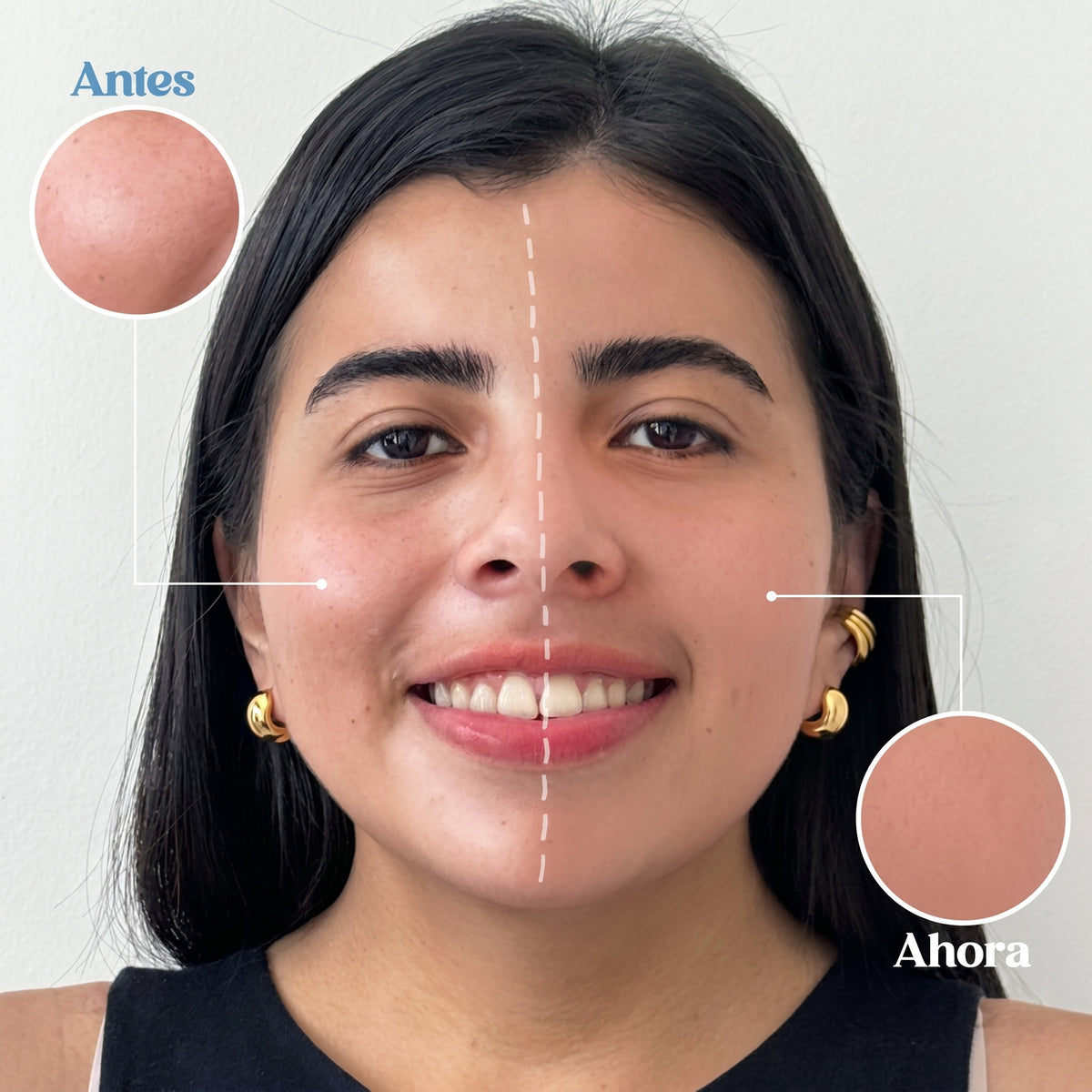 Candy Bella | Gel prensado para control de grasa facial